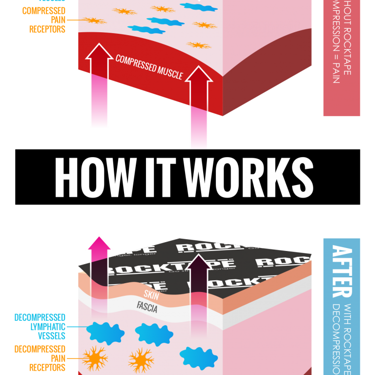 Rocktape